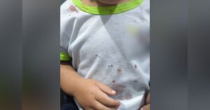 Uma criança com manchas de sangue na camiseta branca com gola verde